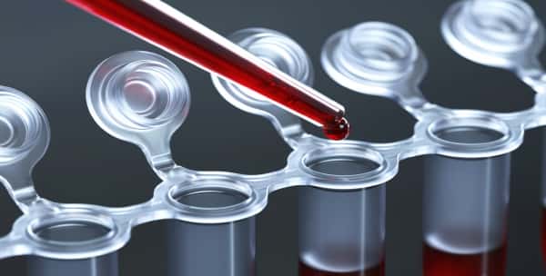 анализ на магний анализ на магний